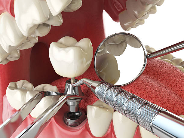 Best Emergency Cosmetic Dentistry in Albany, KY